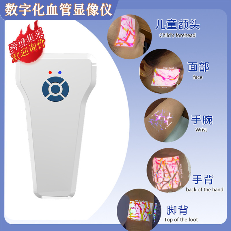 外国貿易静脈血管検出器医療顔/腕血管検出器投影血管検出器|undefined
