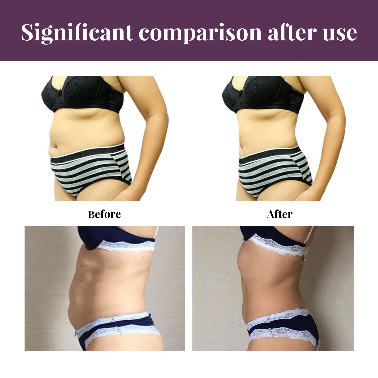 EELHOE lymphatic magnetic suction body large belly, tight and shaping waist fat, slimming patch for_voghion.com