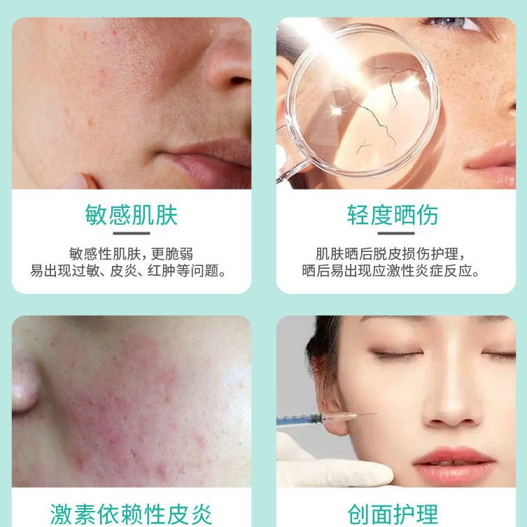 美容整形外科専用医療修復スプレー保湿保湿機械ブランド医療皮膚修復ドレッシングスプレー|undefined
