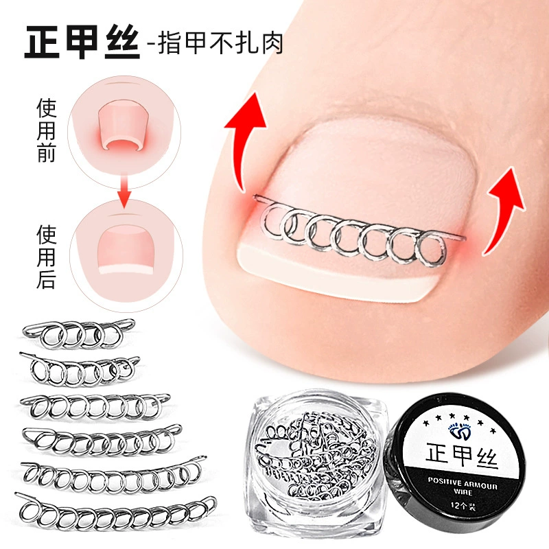 Кусачки для ногтей устройство для инкрустации ногтей палец ноги ножницы для ногтей проволока из нержавеющей стали педикюрные плоскогубцы для коррекции ногтей ног