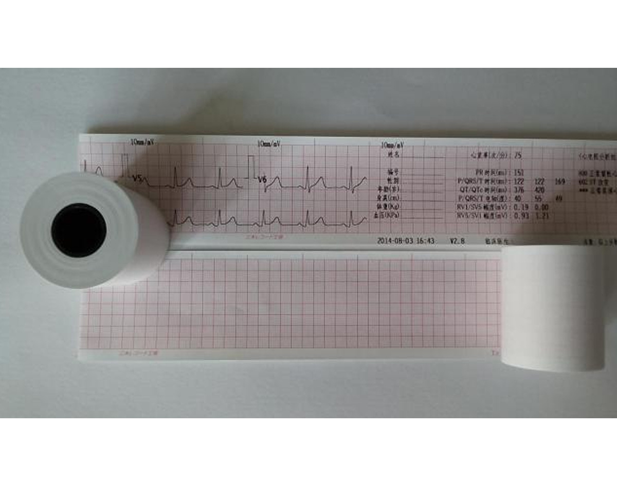150*100-150P CTD7胎监纸胎儿监护仪纸、热敏打印纸|ru