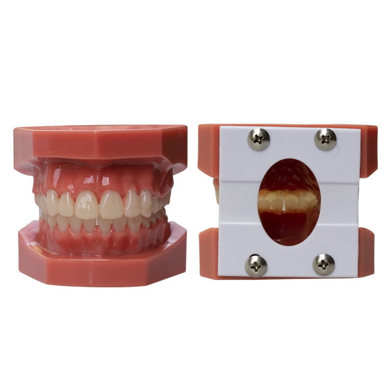 Modelo dental, modelo de corrección de demostración de mandíbula incorrecta, práctica de dentista, modelo de brackets pegajosos, molde de enseñanza de corrección
