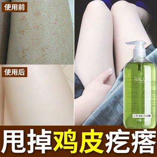 RALU������ԡ¶����坍ȥ�uƤ���|ȥ���\�x���w���B���w����ͣ��