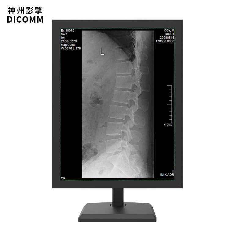 3M Color Medical Display Diagnostic CT Vertical Screen Grayscale Medical Display Medical Display 21.3 Inch 3M Color Medical Display Diagnostic CT Vertical Screen Grayscale Medical Display Medical Display 21.3 Inch