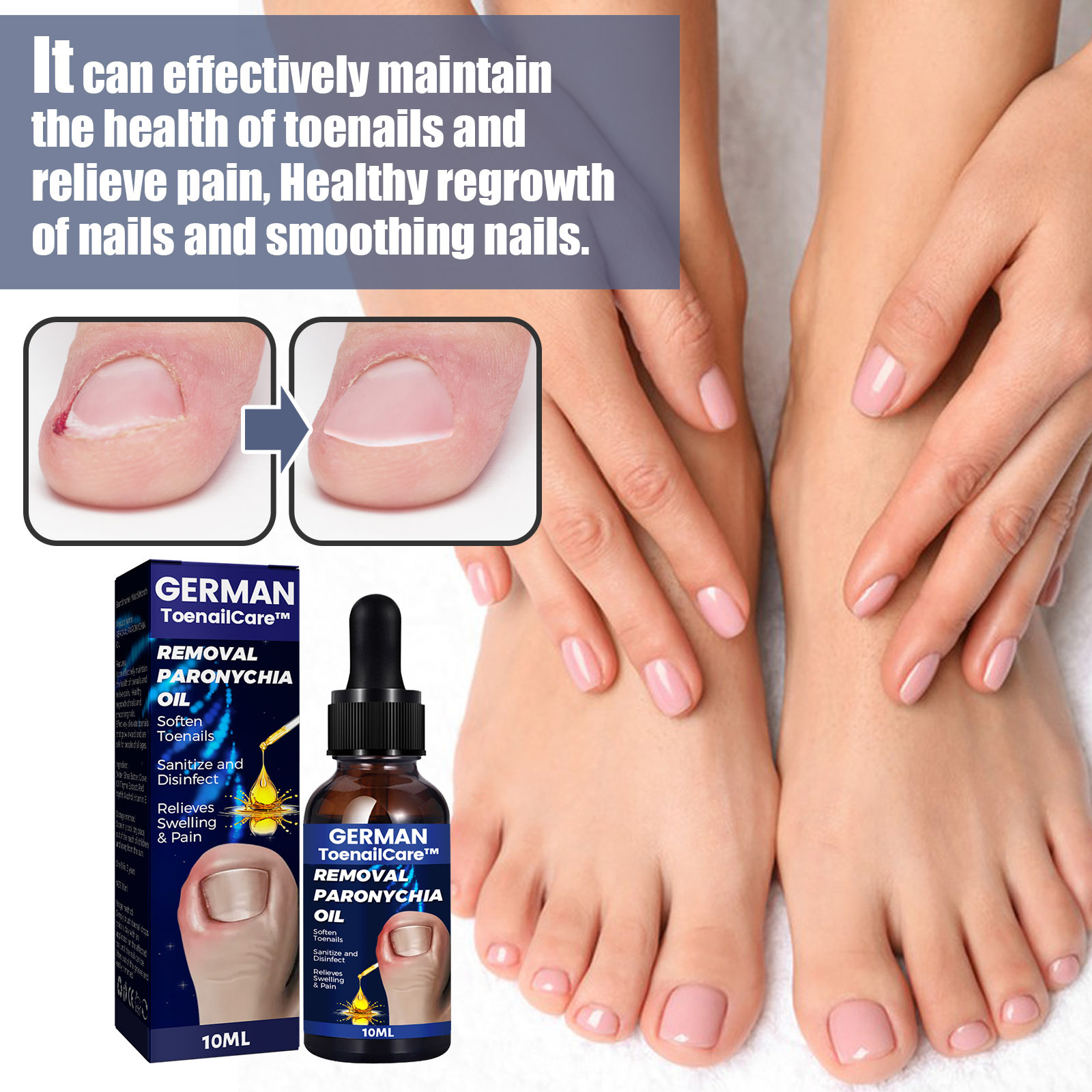 Nail Repair Oil, Nail Correction, Ingrown Nail Repair, Soft Nail Thickening, Finger and Toe Nail Care Oil