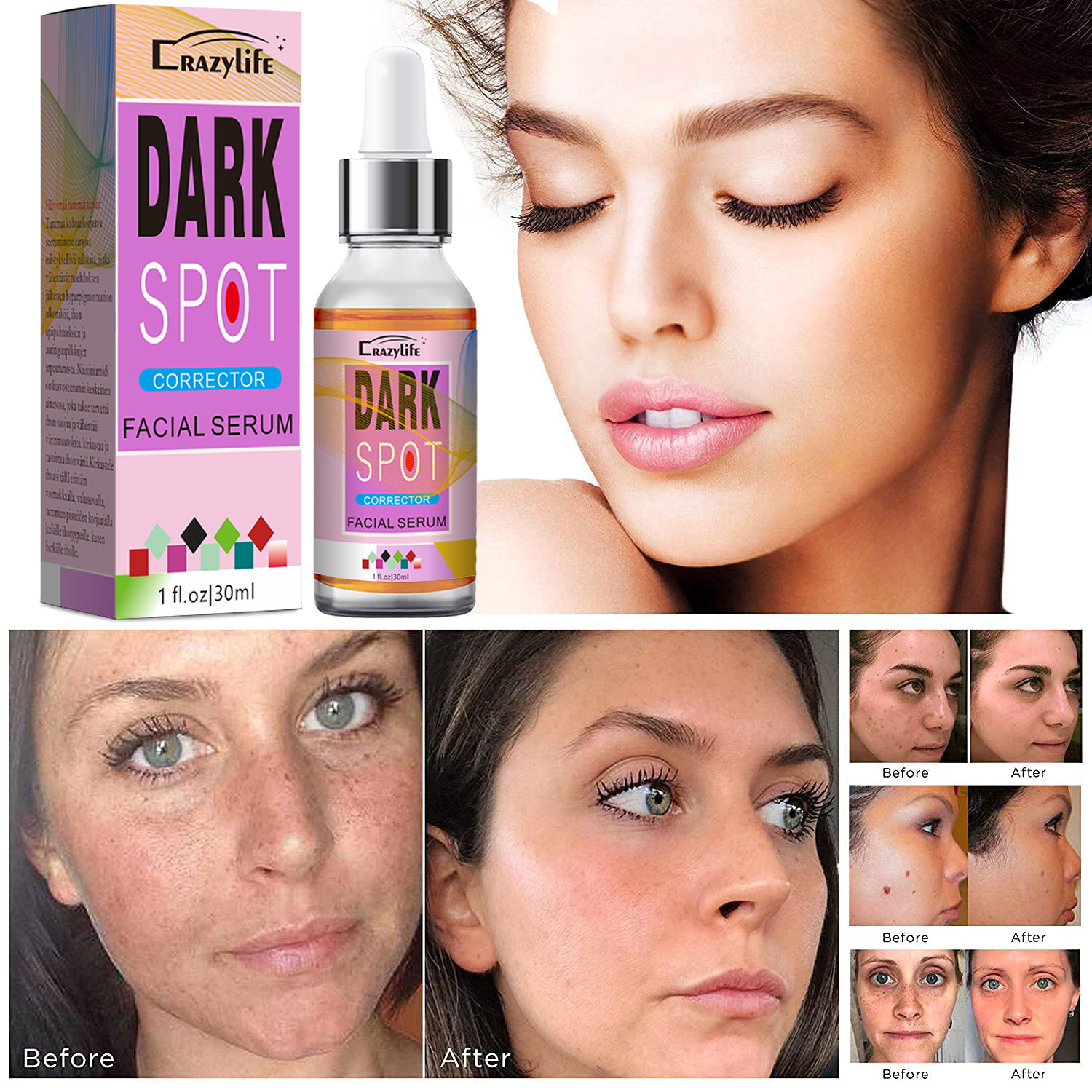Siero viso anti-macchie per un colorito uniforme e luminoso_voghion.com