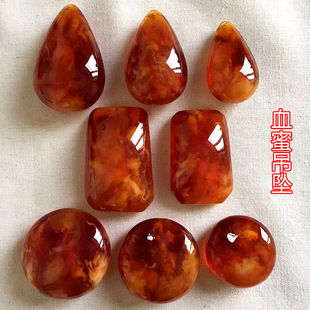 ����Ѫ��ˮ��ƽ���o���ƹ����۵����朒����Ϟƽ���Ƶ���������