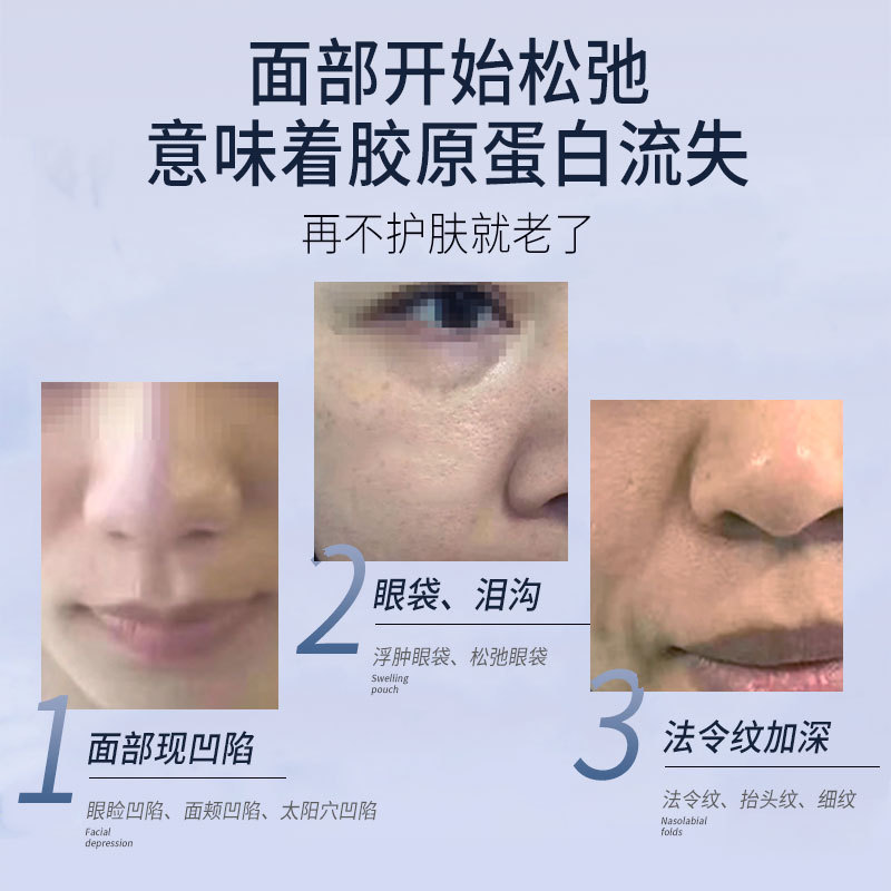 童颜再生细胞激活填充一次成型不回落面部凹陷丰太阳穴泪沟冻干粉|undefined