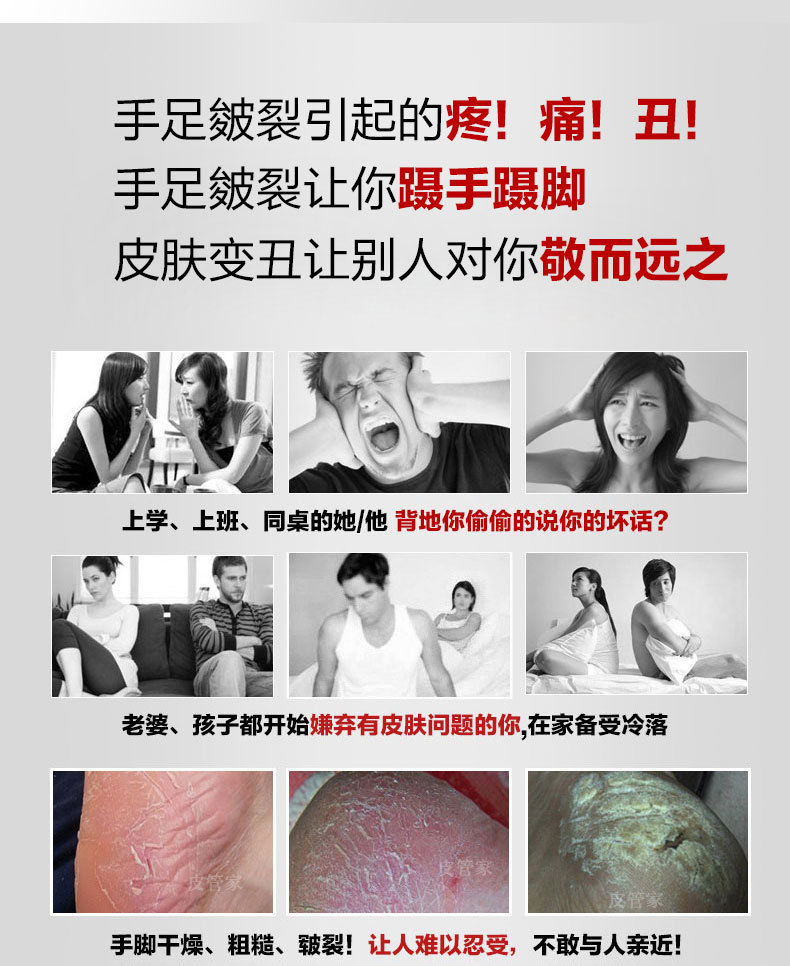 华人冻裂膏抗裂修复霜防裂脚裂膏脚后跟龟裂手裂口干裂蜕皮护手霜-阿里巴巴