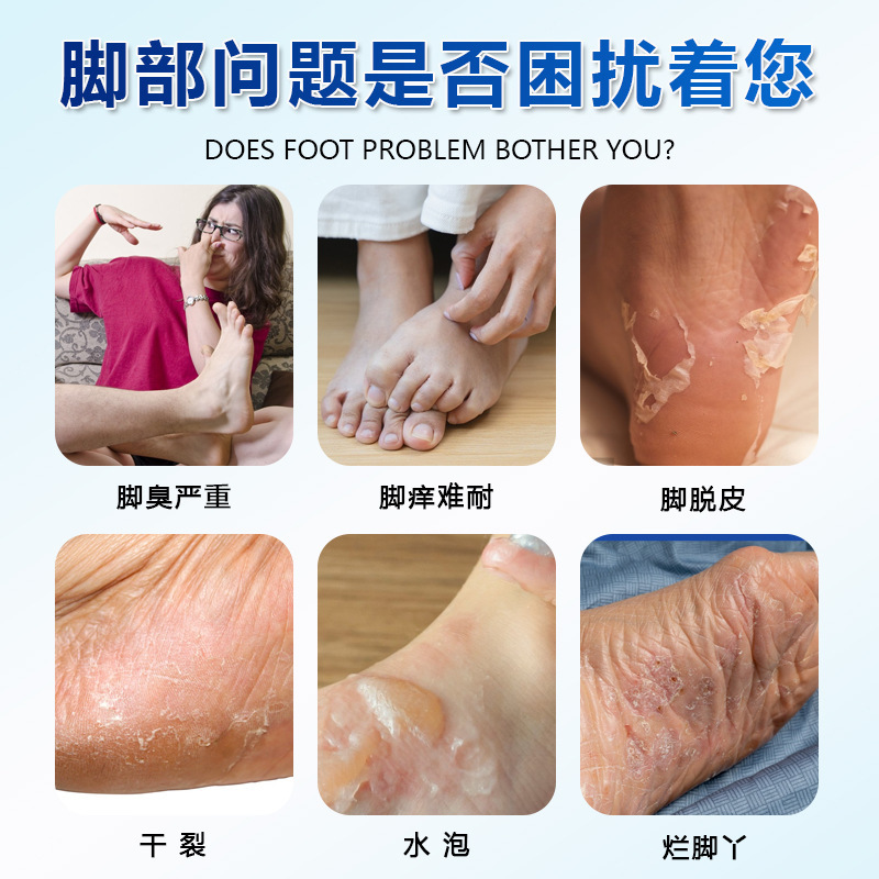 德国靡浩览娅脚康止痒膏脱皮脚臭脚部护理膏脚痒脚疱止痒膏批发|undefined