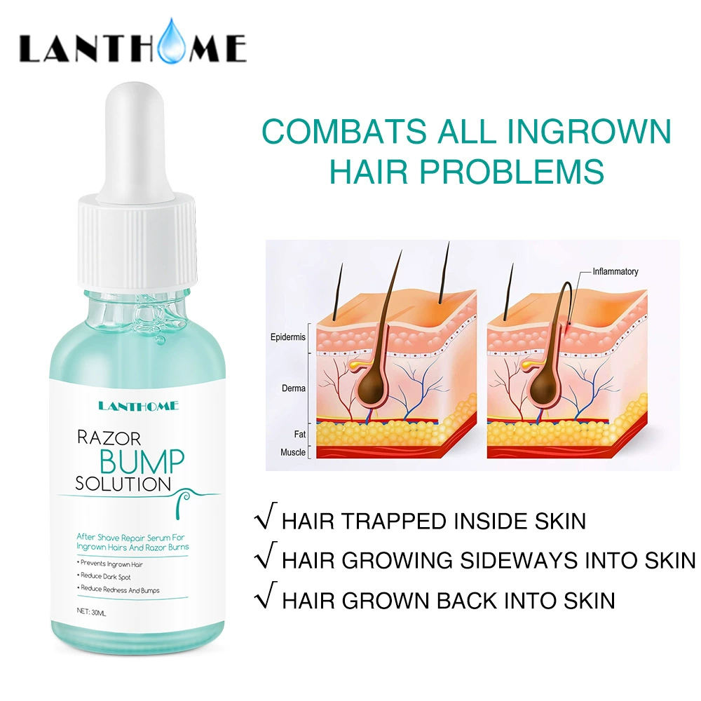 莲碧泉lanthome Prevent growth in hair