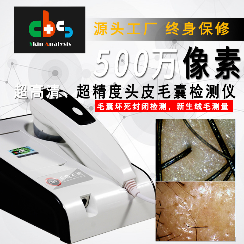 【源头厂家】CBS601正版 500万像素毛囊头皮毛发检测分析测试仪器