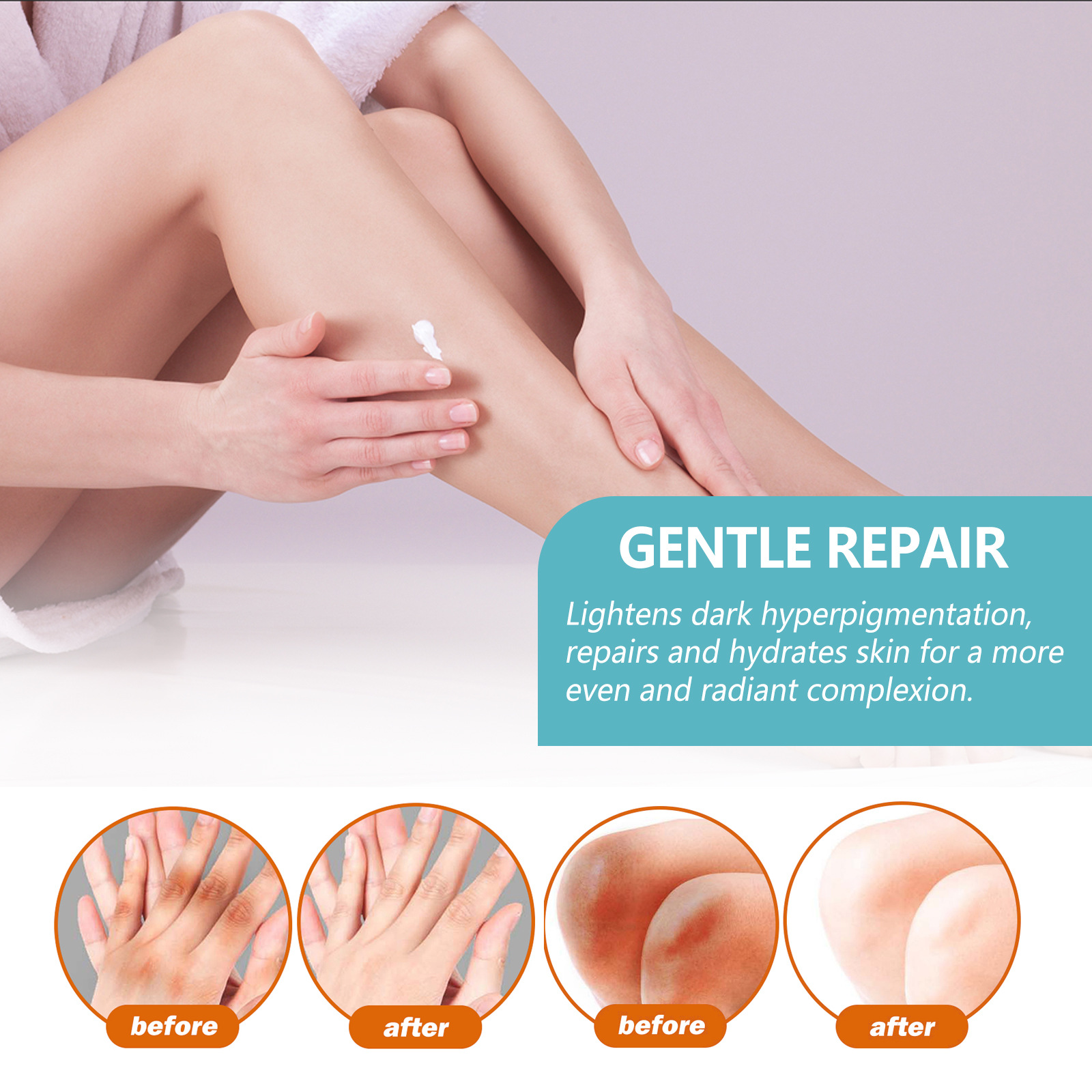 EELHOE crème réparatrice d'acanthe noire réparation aisselles bras articulations des genoux crème de soin du corps hydratante blanchissante noire_voghion.com