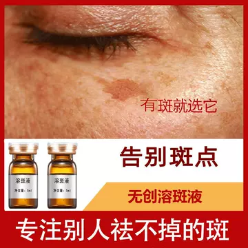 Plaque dissolving solution can dissolve Melasma melanin without scab. Microcrystal introduction can repair and dissolve plaque. Non invasive spot dissolving solution for sunburn - ShopShipShake