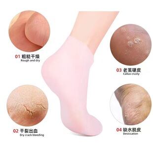 Socks silicone anti-cracking full foot cover heel ti protective cover men's and women's foot protection moisturizing low-cut boat Socks