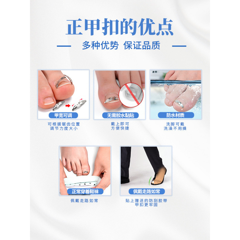 甲沟矫正器贴嵌甲正甲扣脚趾甲贴片长到肉里神器纠正指甲卷专用炎|undefined