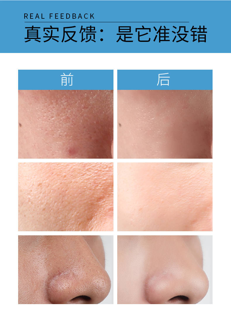 收毛孔新配方详情-4.jpg