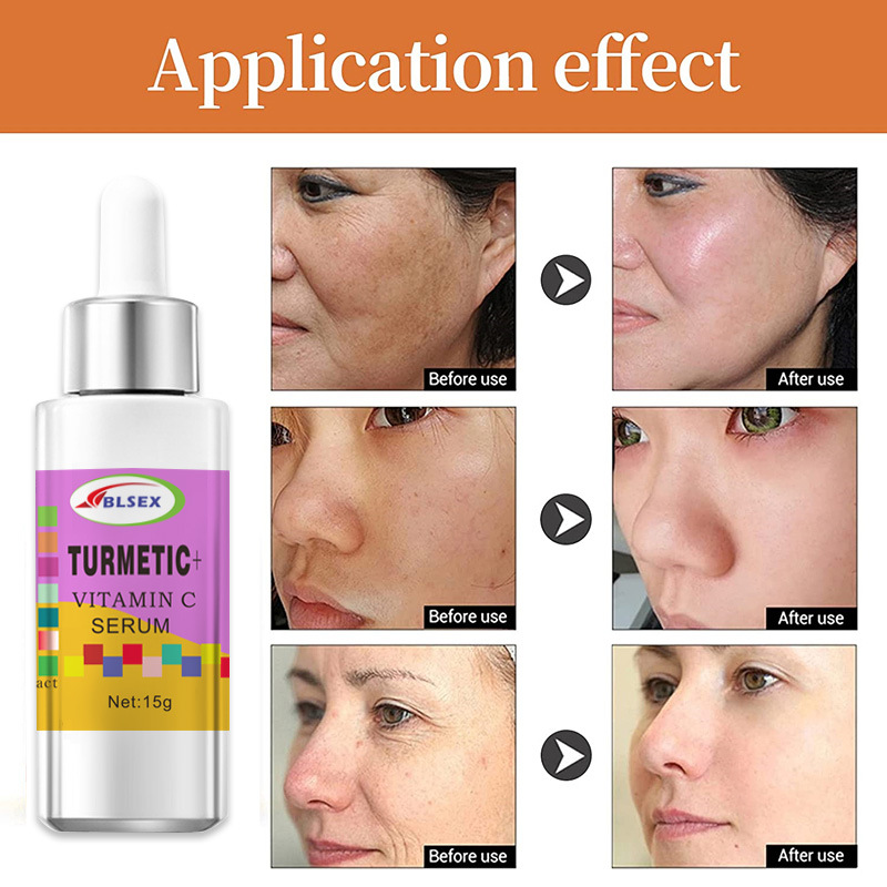 Siero alla vitamina c con olio di curcuma idratante viso_voghion.com