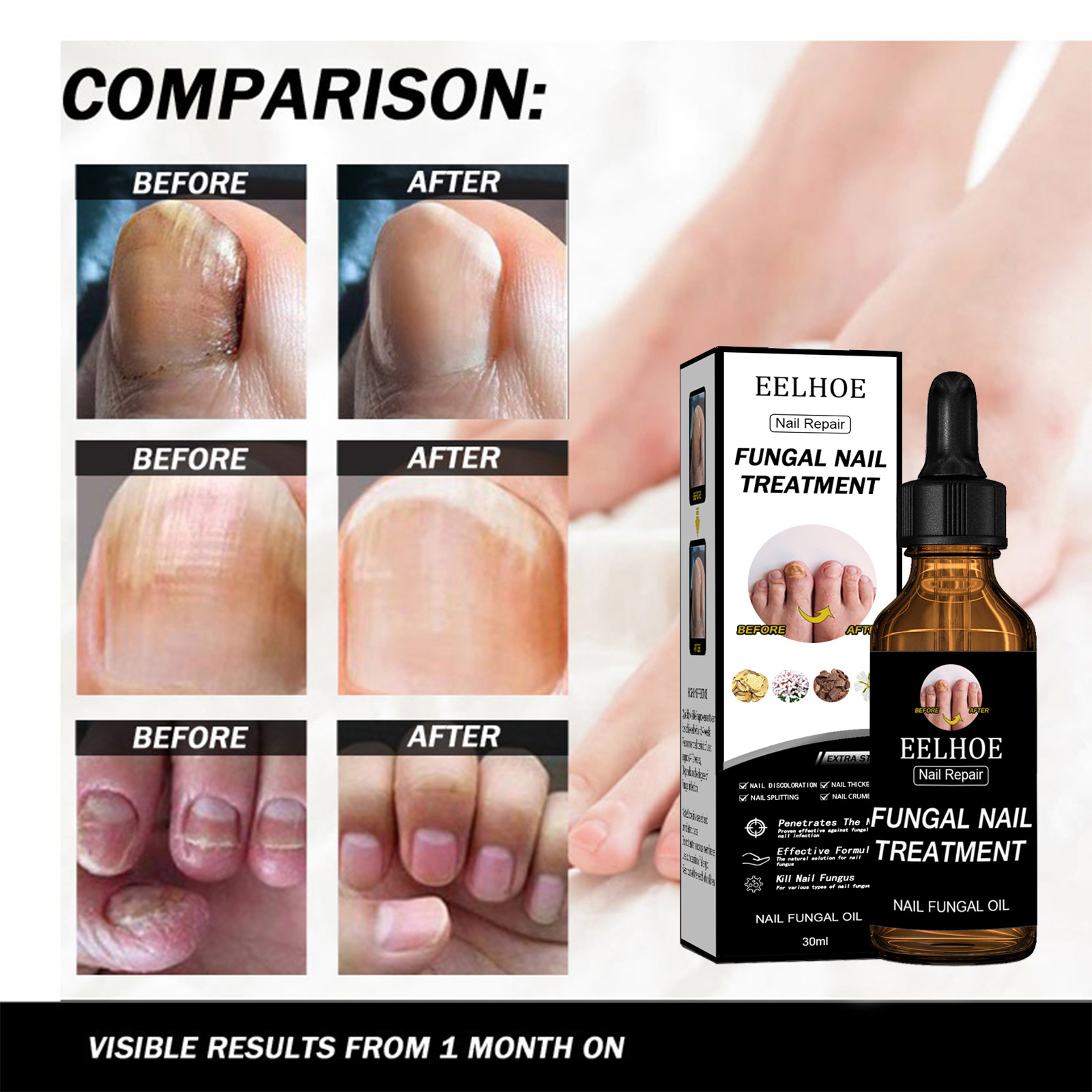 Repara, espesa, ilumina las uñas, elimina las canas, repara la piel muerta y nutre las uñas, mejora la nutrición, cuidado 2024 mejor_voghion.com