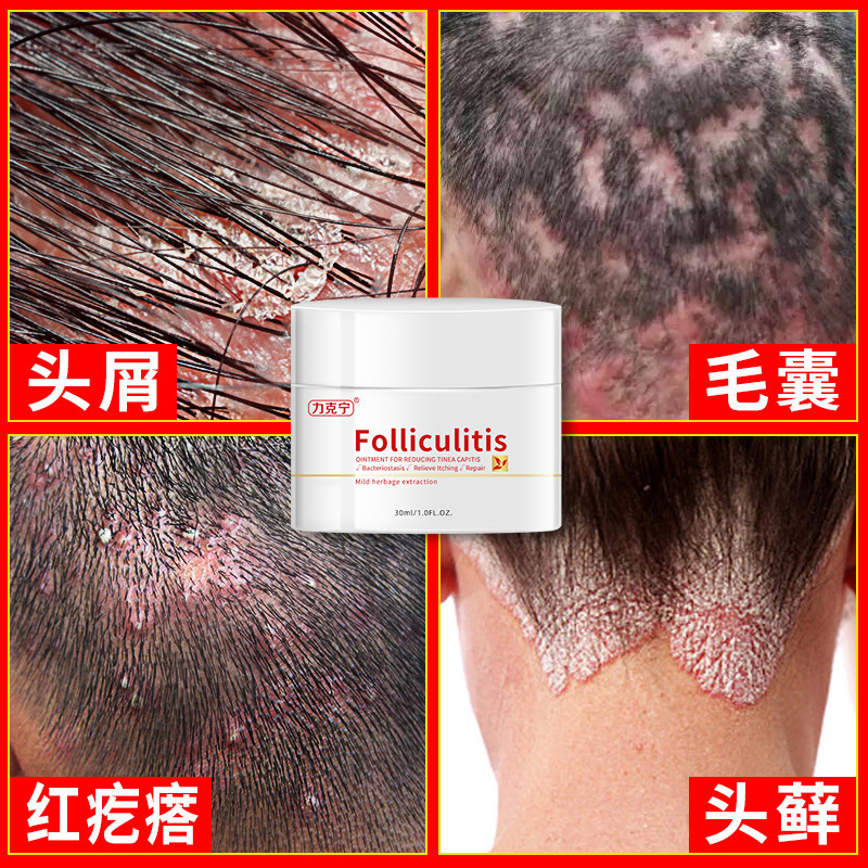 Likining Herbal Dermatitis Wolf Toxin Antibacterial Cream Head Itching Scalp Cleansing External Antipruritic Shampoo Cream Likining Herbal Dermatitis Wolf Toxin Antibacterial Cream Head Itching Scalp Cleansing External Antipruritic Shampoo Cream