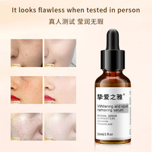 ����377����ȥ�ڰ߾���Һȥ�ڻ�ɫ��ԭҺ�羳��óFreckle Removal
