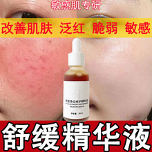 美容院专供激素脸修复液去红血丝增厚角质层舒缓敏感肌退红精华液