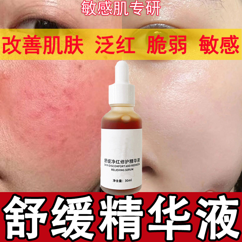 美容院专供激素脸修复液去红血丝增厚角质层舒缓敏感肌退红精华液