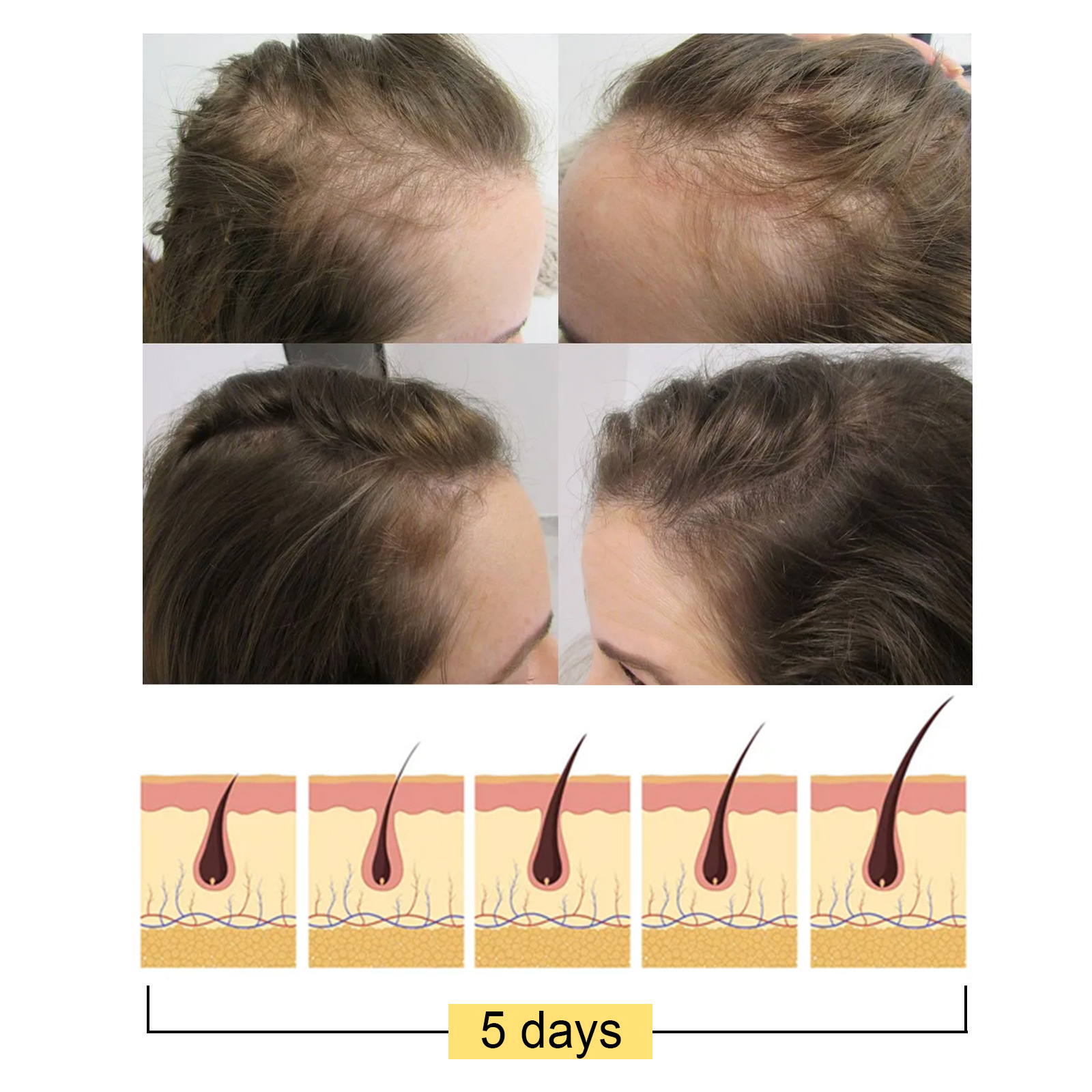 Jayswing Rice essence Hydraterende verzorging Bevordert de haargroei Voedende herstellende shampoo_voghion.com