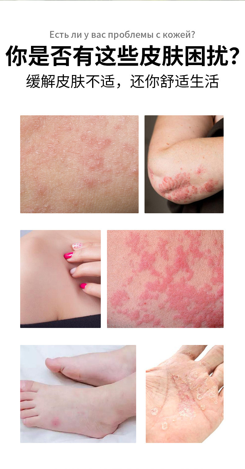 Thai Itch Relief Ointment External Skin Balm 20g Traditional Herbal Topical for Neck Area quality and texture