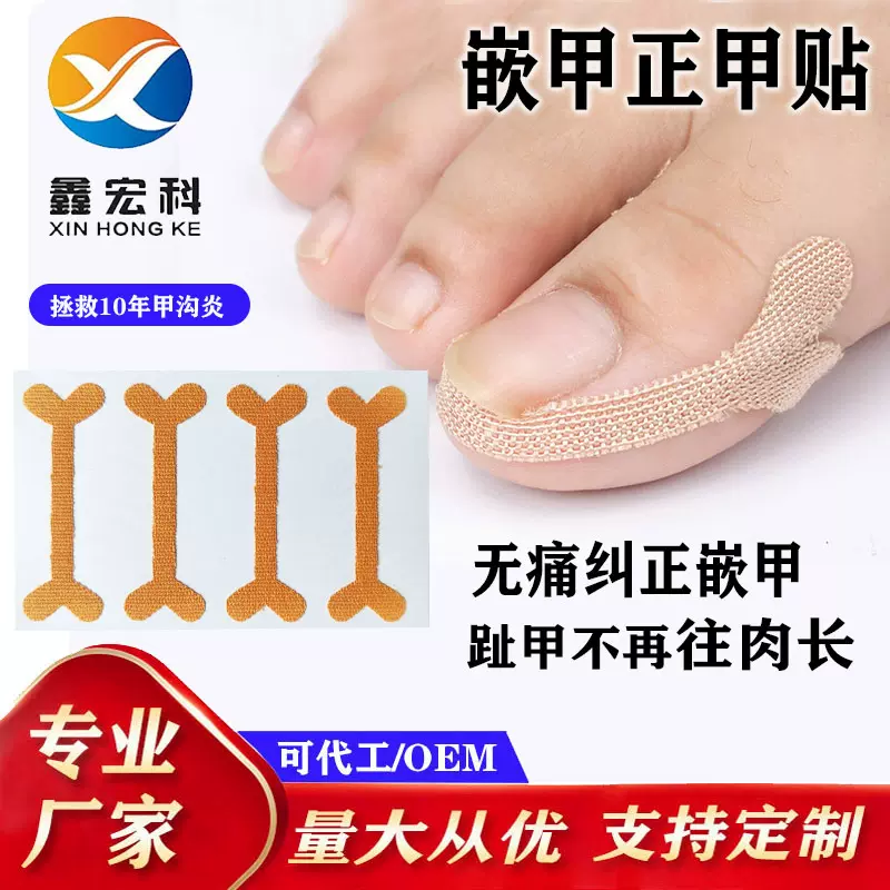 爱心款正甲贴嵌甲贴厂家防往肉刺脚趾甲脚指甲套装指甲纠正贴片