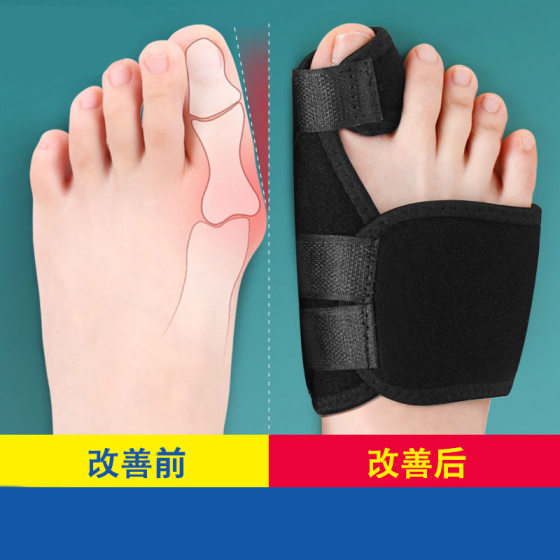 Aluminum Foot Thumb Orthotic Toe Protector Adult Toe Valgus Corrector with Big Foot Bone Separation Artifact
