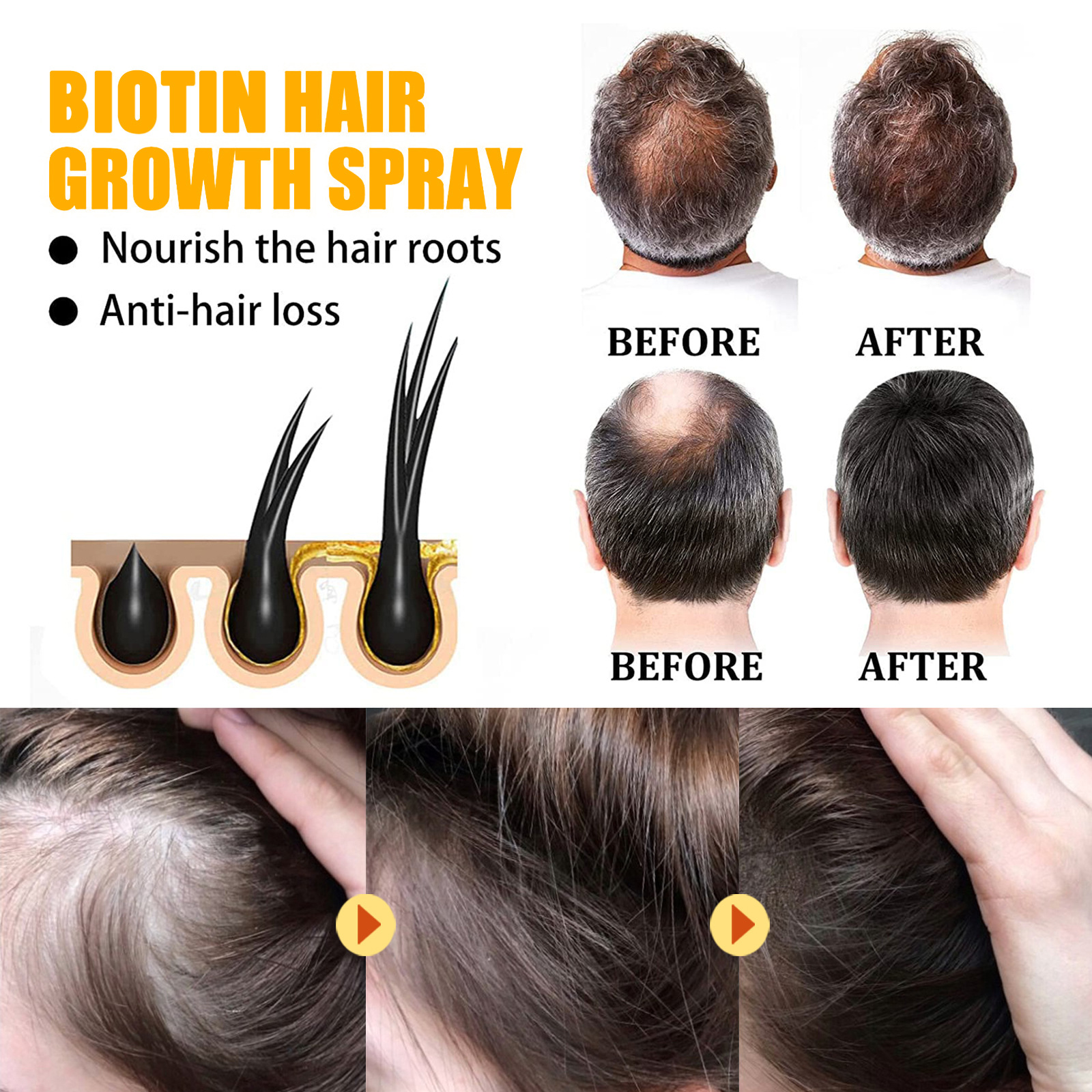 Spray capilar denso con biotina EELHOE, reparador y nutritivo para el cabello, cuidado del cabello, fortalecedor del cabello, spray antienvejecimiento para las raíces_voghion.com