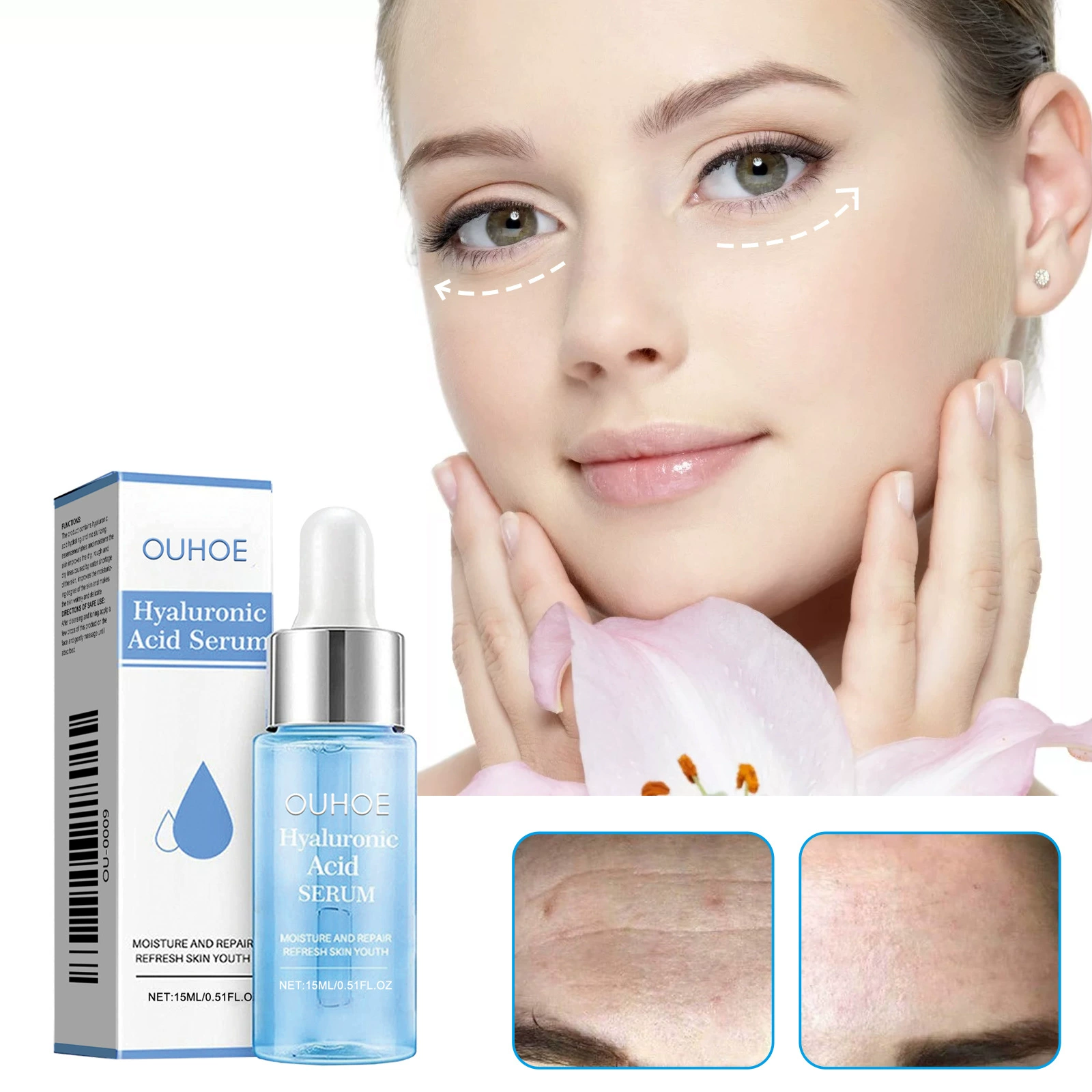 OUHOE гиалуроновая кислота Глубокая сыворотка против морщин омолаживает кожу