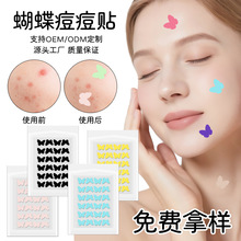 ��ɫ����ˮ�z�w�����N��覸��x�ڶ��N�ɐ����β�ɫ�����N���R�d