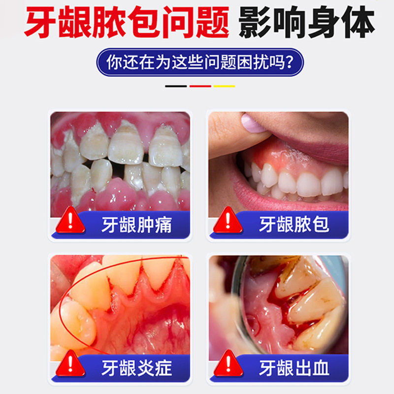 Dr.BorisArzt牙龈肿痛萎缩智齿牙根发炎止疼牙肉牙疼专用神经喷雾|undefined