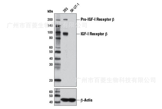 IGF-I Receptor β (D23H3) XP?Rabbit mAb #9750