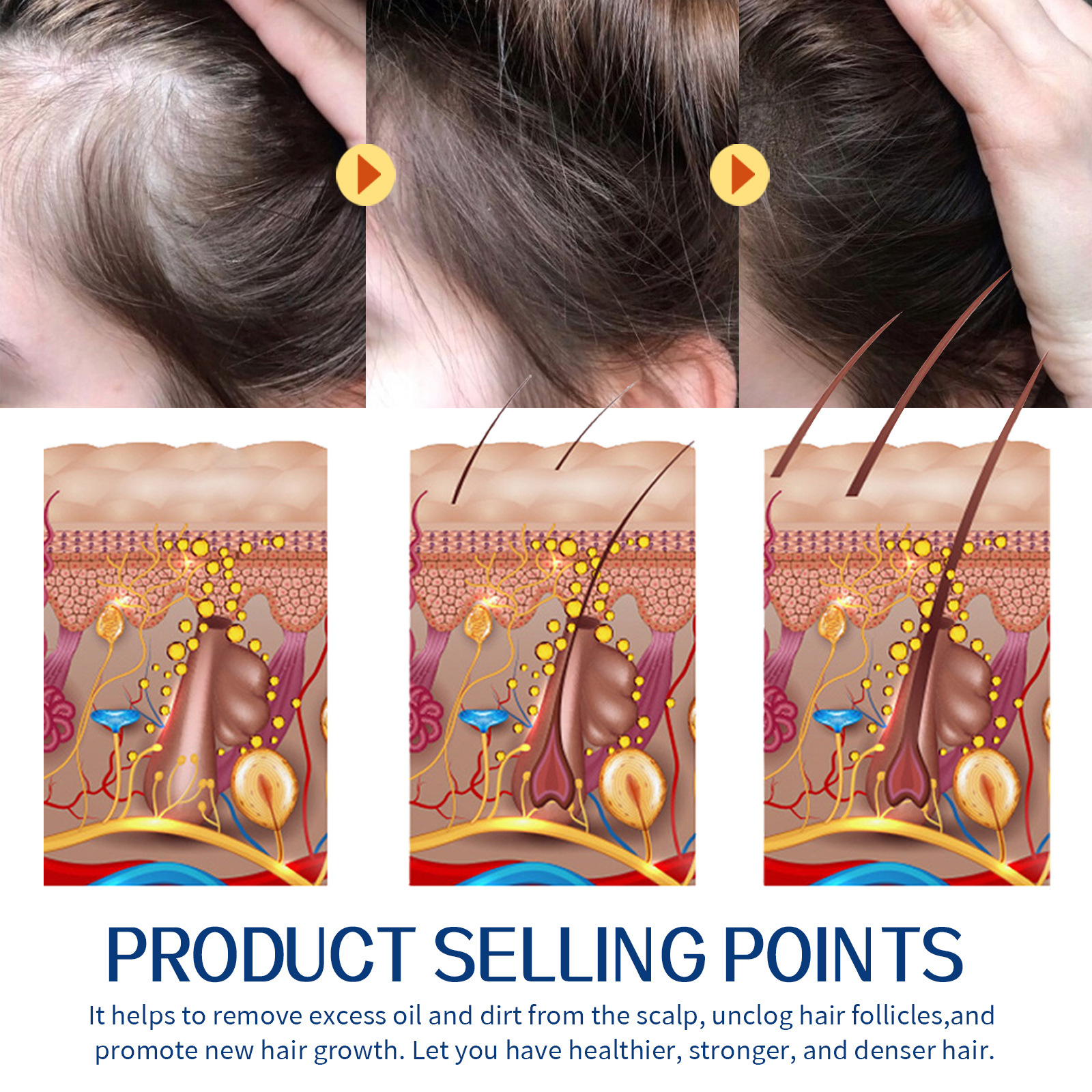 EELHOE Haarpeeling-Reinigungscreme gegen Schuppen auf der Kopfhaut, lindert Juckreiz, flauschiges, feuchtigkeitsspendendes, dichtes Haar, Haare_voghion.com