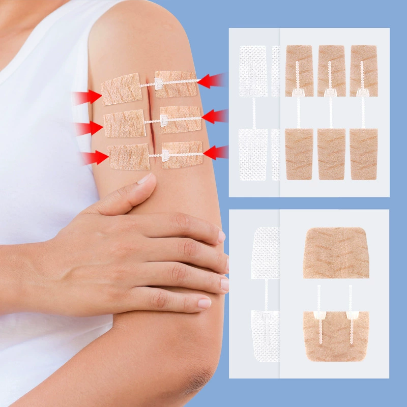 Сшитая самоклеящаяся повязка на молнии без нетканого двустороннего ремешка пластырь эластичная кожа