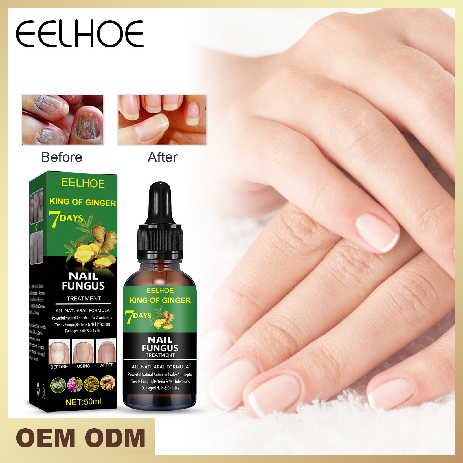 repair Beautiful nail solution, hand and foot nail care solution, repairing gray nails, shining nails, soft nails,   s,_voghion.com