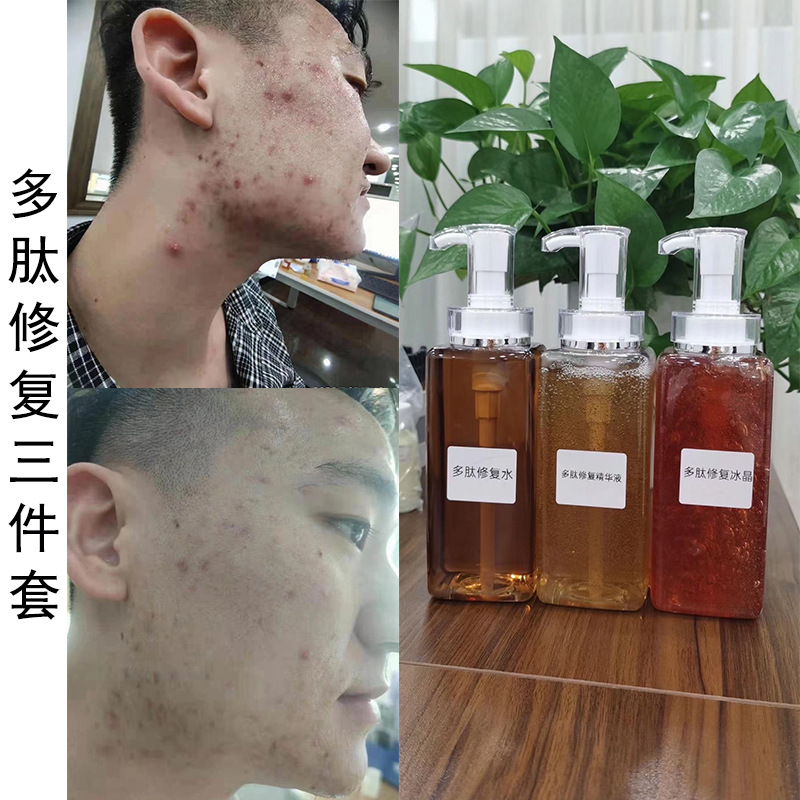多肽修复原液舒缓敏感肌修护角质层净透提亮冰晶修复精华原液oem|ms