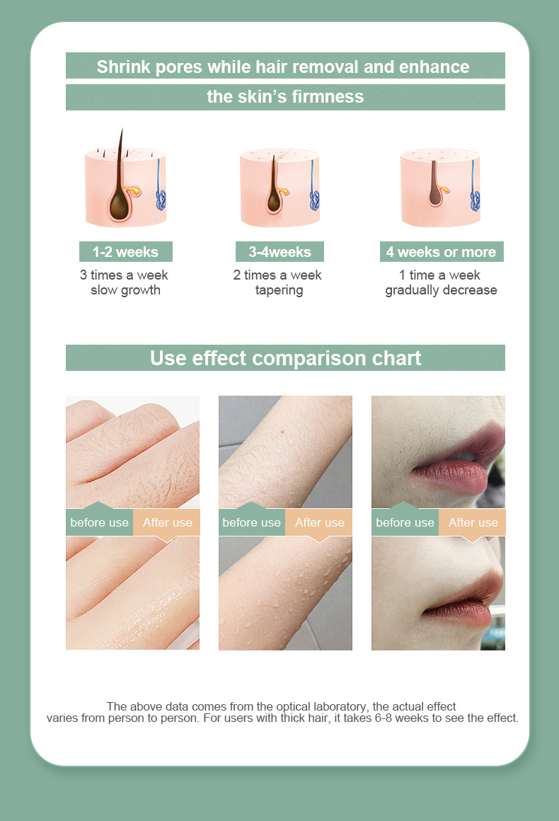 KT5英文脱毛仪_04