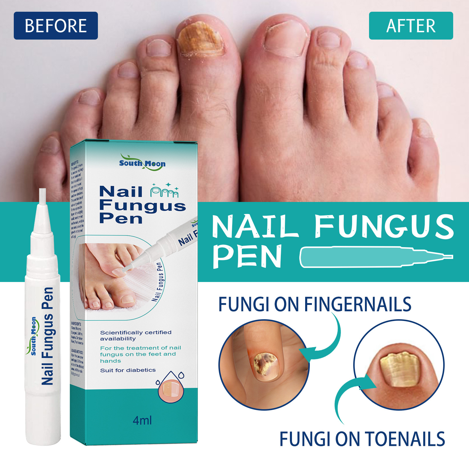 Stylo, ongles gris, ongles épais, doux et brillants, liquide nutritif nettoyant et réparateur de la couche de cuticules_voghion.com