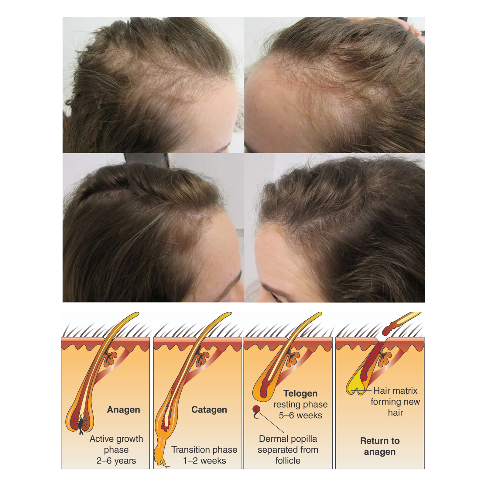 Split End Repair