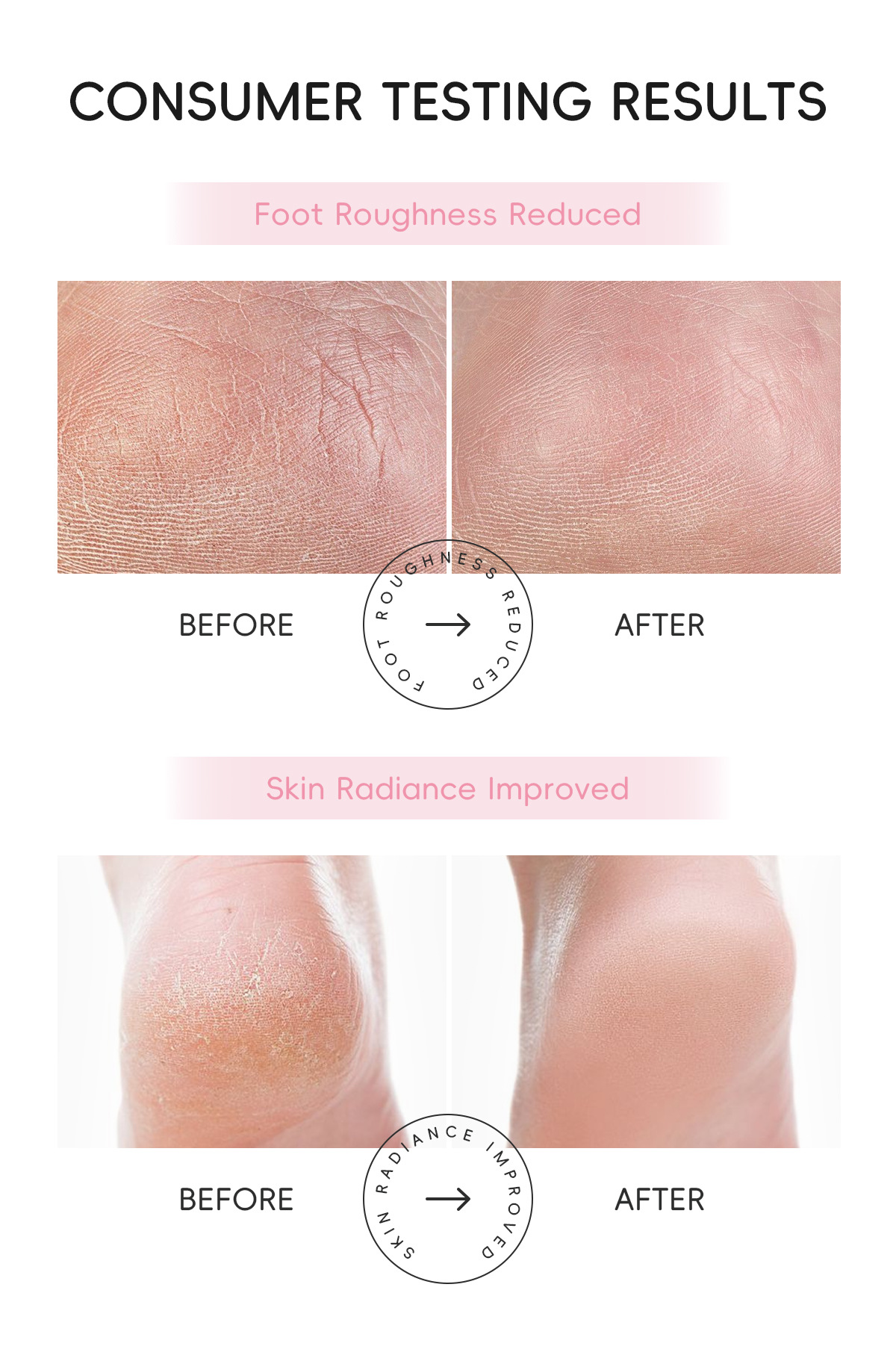 Laikou Cherry Blossom Foot Bath Salt 50g+50g hydrates, moisturizes, cleanses and leaves a lasting fragrance. Factory in stock, one-piece consignment undefined