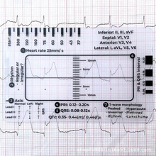 【大量现货】跨境新品ECG 7 Step Ruler心跳心电图观察步标尺