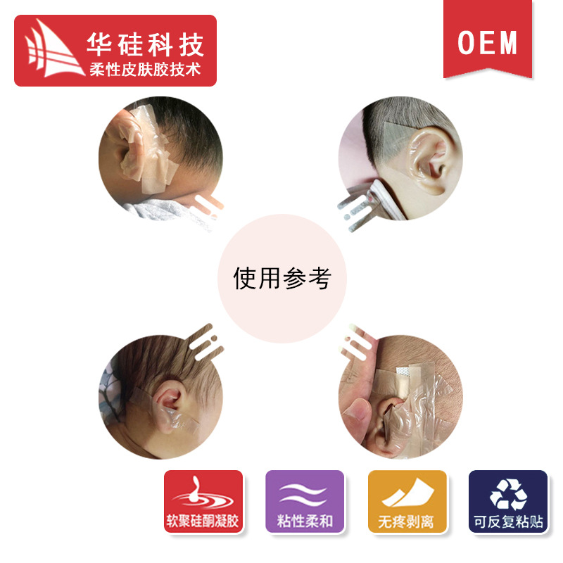 Super alta cinta adhesiva de gel de silicona bebé viento oído corrección pegatinas niños oído pegatinas bebé piel color deformidad corrección pegatinas
