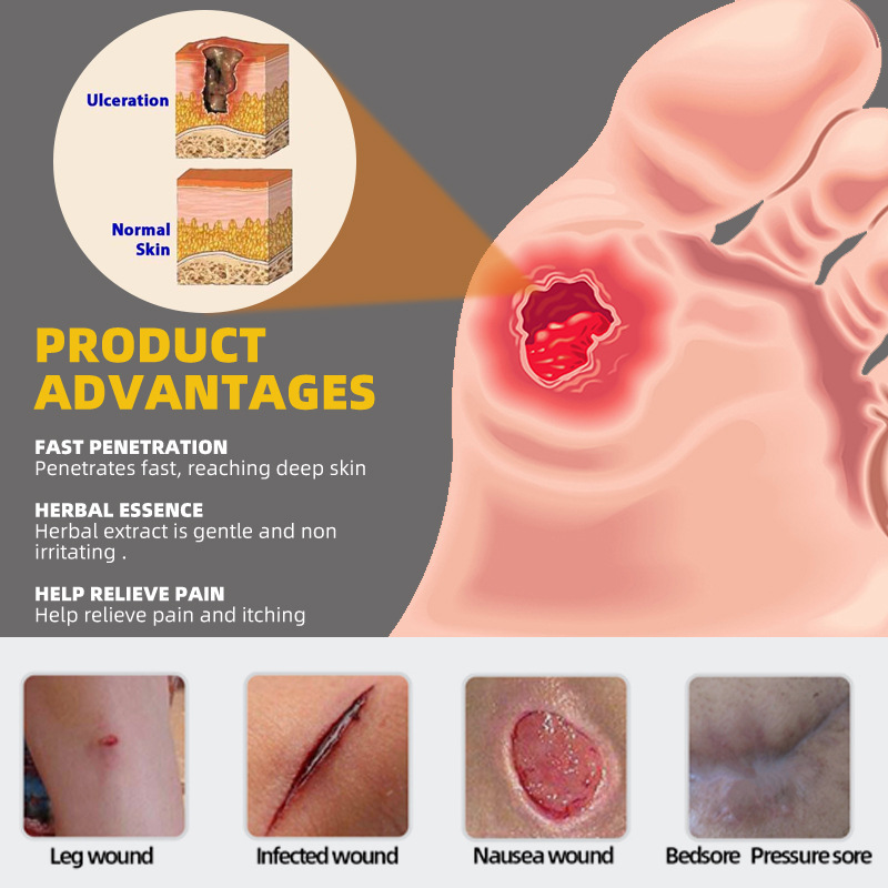 неопределенный