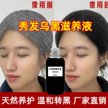 �װl�D�ڰl���AҺ���l���B�^Ƥ���oë�Ұ��D�ں��מ��I�B���lҺ