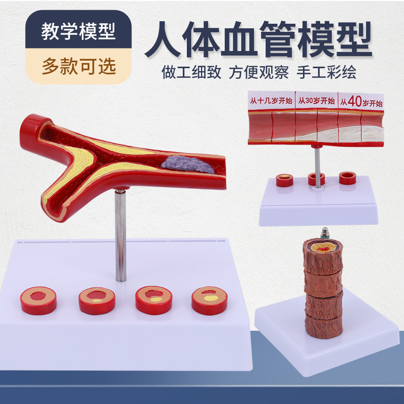 Ѫ��/���� ѪҺŨ��֬�� ����ѪҺ Ѫ������/Ѫ�ܲ������� ģ��