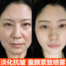 ȥ�����F�������AҺ�aˮ�������������ϵ������yͯ�vĘ�o���F